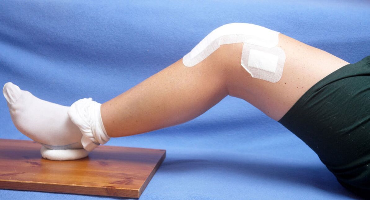 Knee Injury is a Cause of Arthropathy