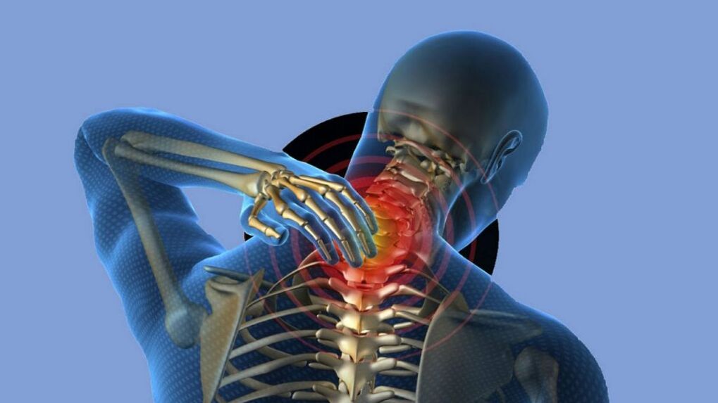 Osteochondral disease in the cervical area