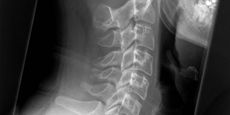 Pictures of the cervical area