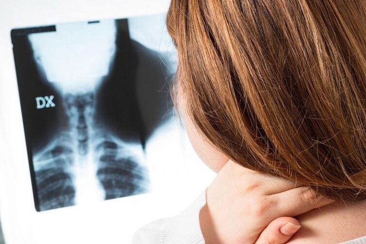 X-rays in the cervical area