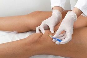 Injection into knee joint to treat arthritis