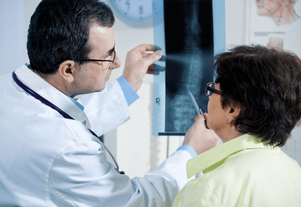 Neurologist uses spinal radiography to diagnose osteochondrosis